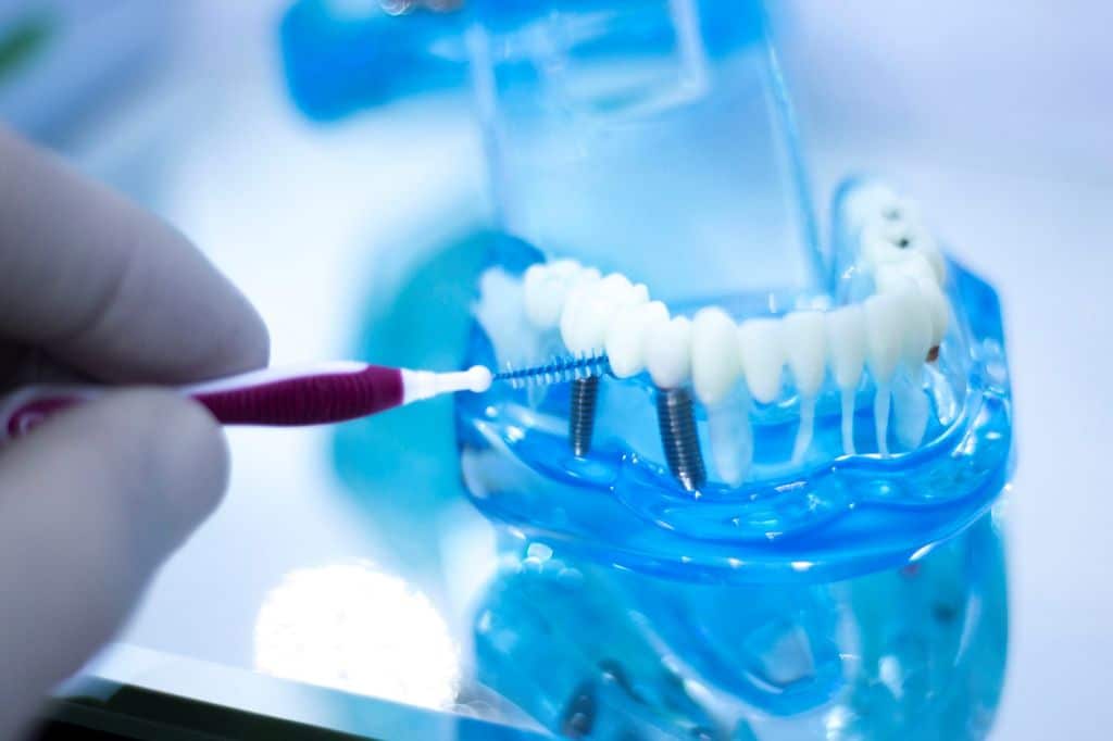 curatarea implanturilor dentare